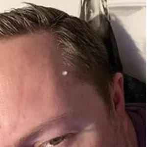 Customer photo review of Bőrkinövés Eltávolító Készlet