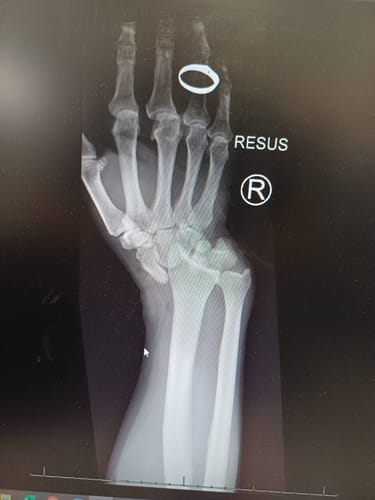 Customer photo review of Throttle Tiger Rider's Wrist Support