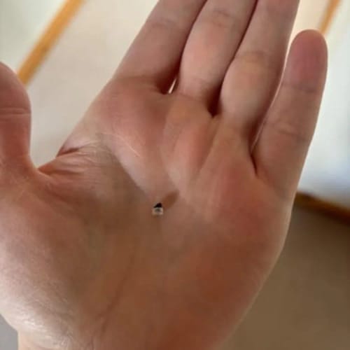 Customer photo review of Bőrkinövés Eltávolító Készlet