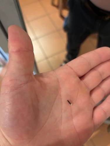Customer photo review of Bőrkinövés Eltávolító Készlet