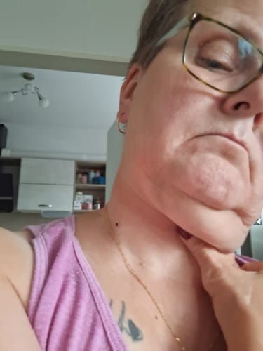 Customer photo review of Bőrkinövés Eltávolító Készlet
