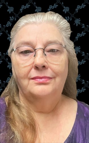 Customer's face after using Grass Fed Tallow & Honey Balm, showing smoother skin on her neck and under her eyes.