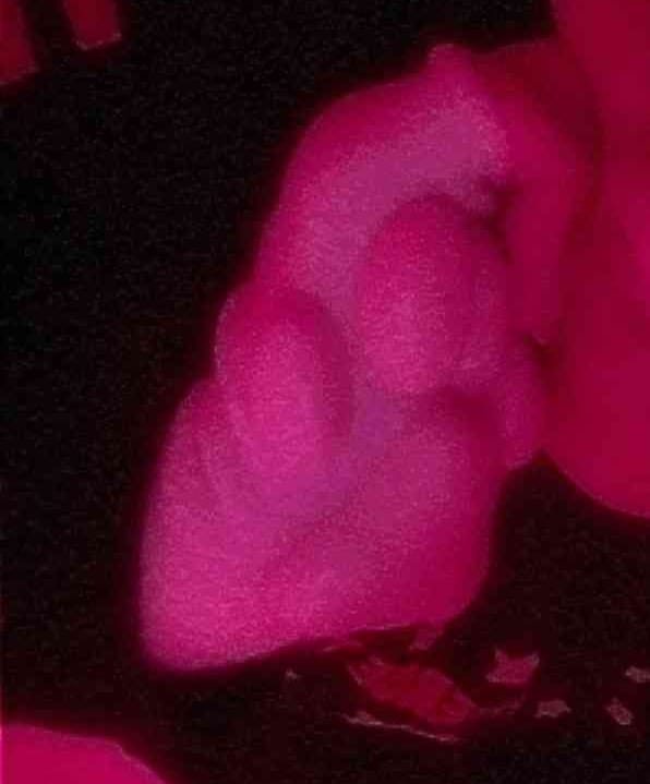 Customer photo review of ToeBeanies White Mittens