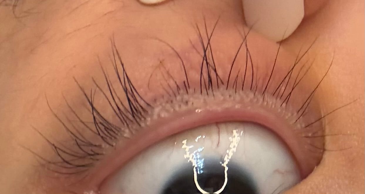 Customer photo review of Eyelash Serum