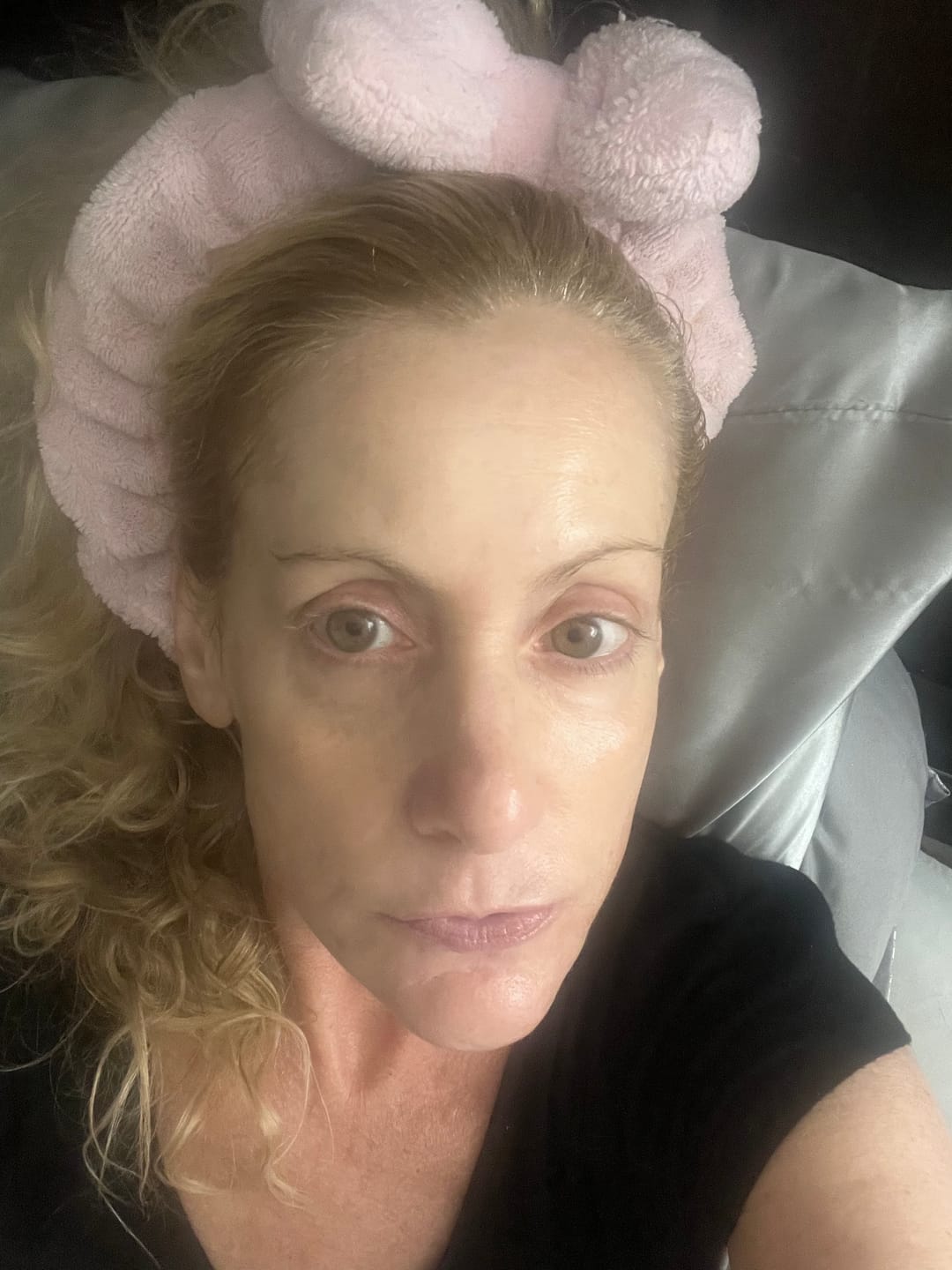 Customer photo review of Glowtopia Prickly Pear Seed Hydrating Face Oil