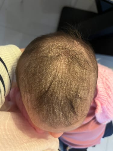 Customer photo review of Baby Scalp Oil