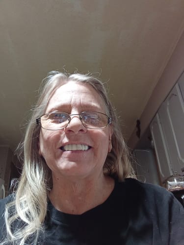 Customer smiling to show a set of bright, natural-looking Pop On Veneers.