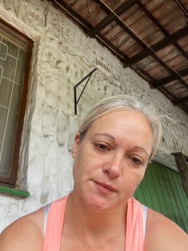 Customer photo review of The Glo Bright Serum