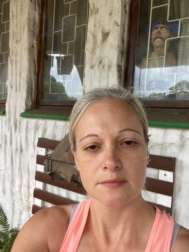 Customer photo review of The Glo Radiance Eye Cream