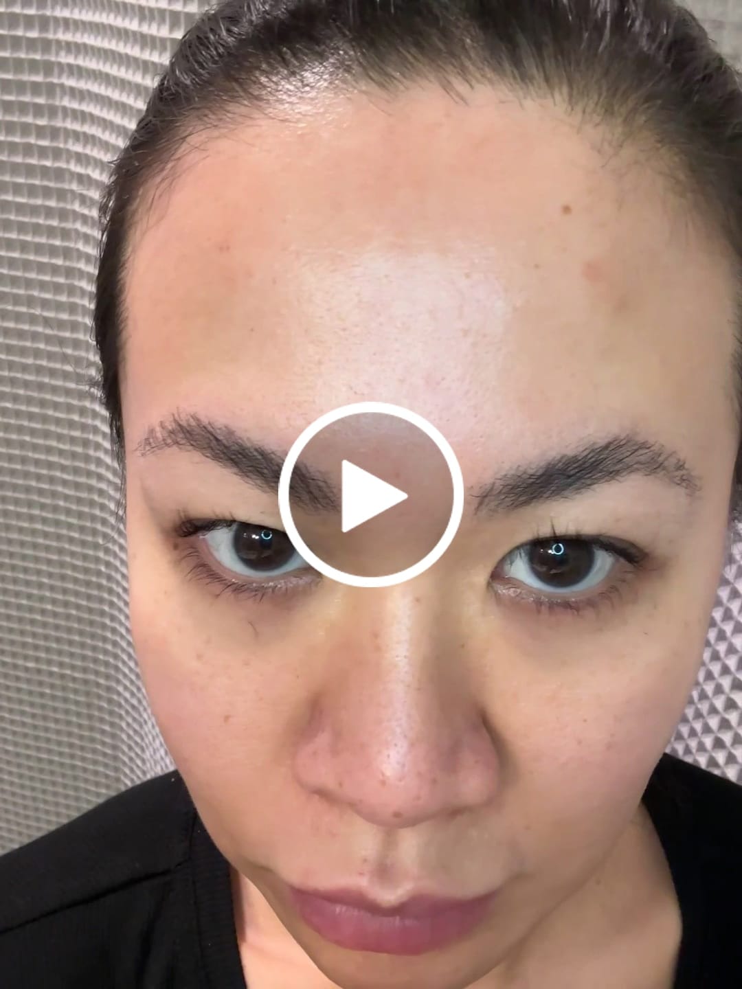 Customer video review of Dr.Youheal PDRN Plus Ampoule - Advanced Anti-Aging Wrinkle Care & Moisturizing