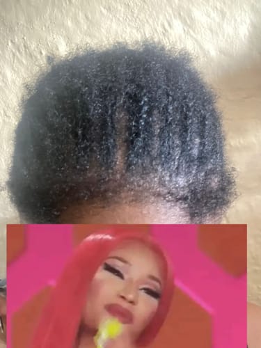 Customer photo review of NOVIFUL HAIR GROWTH FOAM - 50 day supply