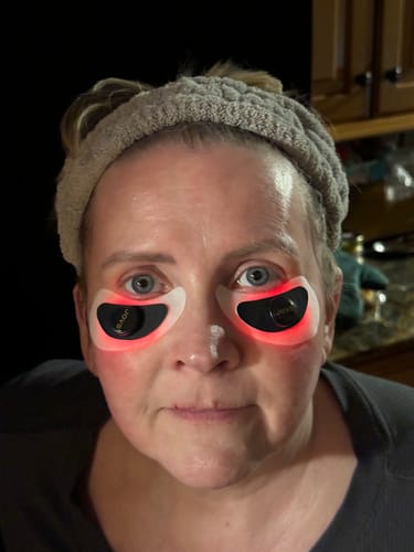 Customer photo review of RevivaEye Collagen Light Eye Patches
