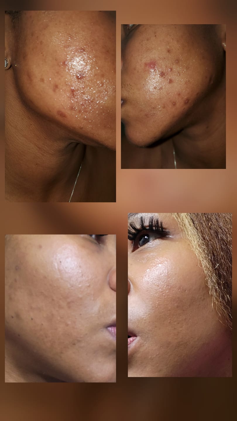 Customer photo review of Brightening Body Oil