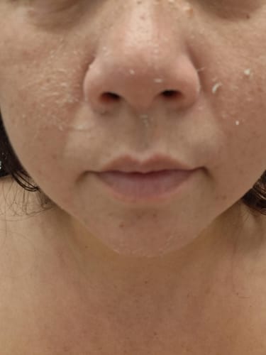 Customer photo review of Peel Shot