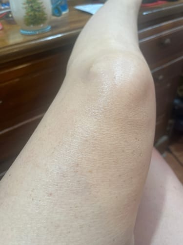 Customer photo review of Besque® Magic Body Oil - Unscented