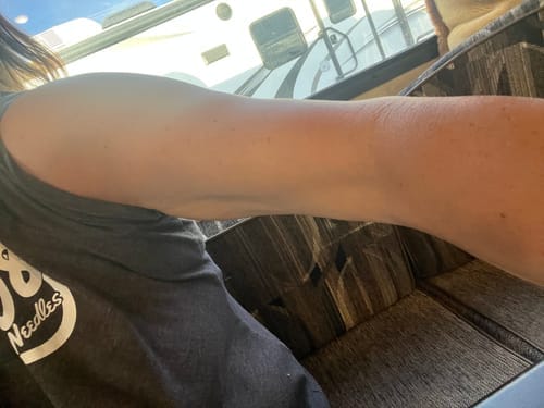 Customer photo review of Besque® Magic Body Oil - Unscented