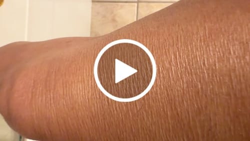 Customer photo review of Besque® Magic Body Oil - 100ml