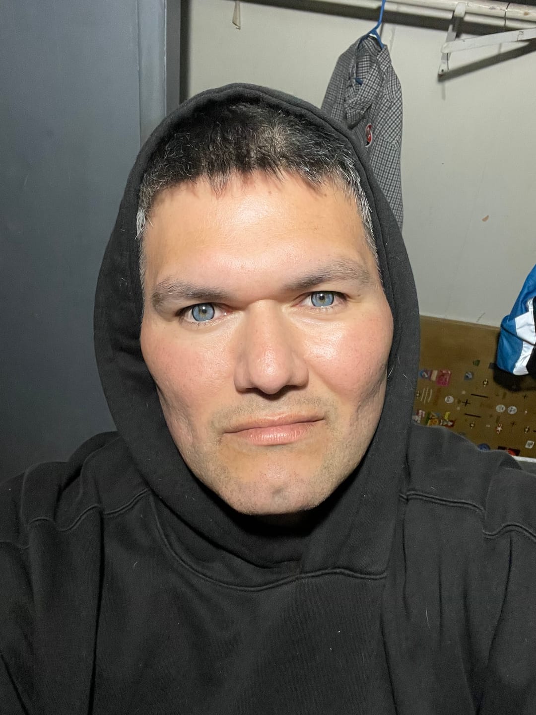 Customer photo review of Norko Blue Prescription Colored Contact Lenses