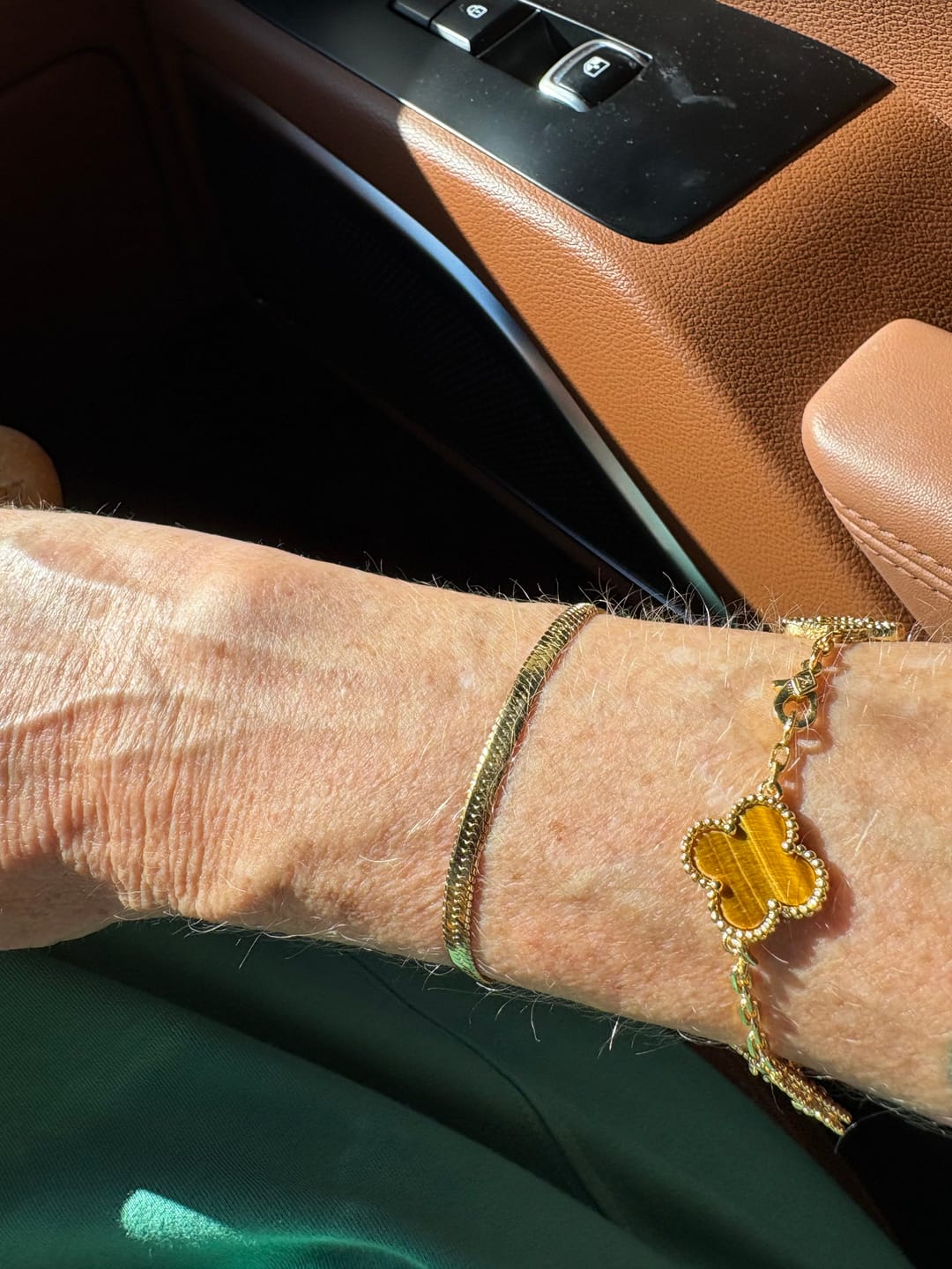 Customer photo review of Essentials Bracelet