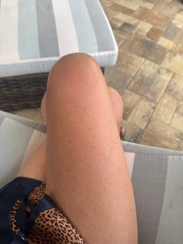 Customer photo review of Besque® Magic Body Oil - 100ml