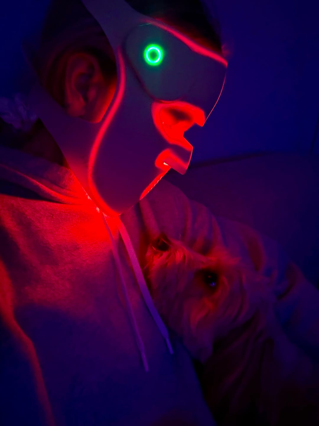 Customer photo review of Hatch Halo™ Dermatologist Grade 3-in-1 Light Therapy Mask