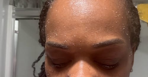 Customer photo review of Peel Shot