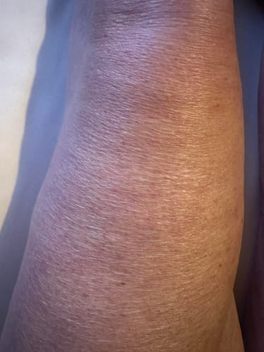 Customer photo review of Besque® Magic Body Oil XL - 200ml