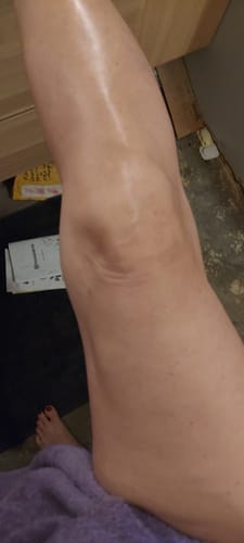 Customer photo review of Besque® Magic Body Oil - Unscented