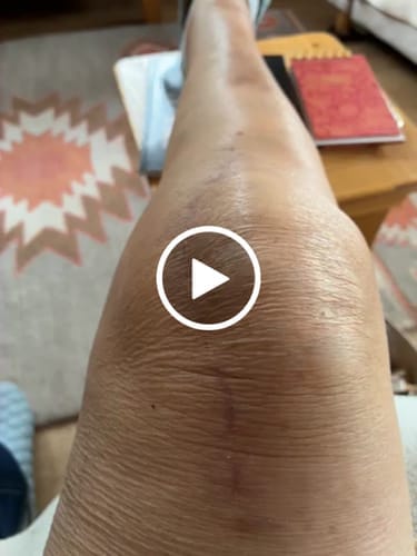 Customer photo review of Besque® Magic Body Oil - Unscented