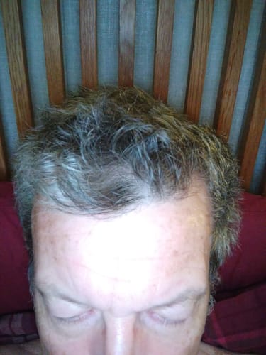 Customer photo review of Seb Natural Calming Serum
