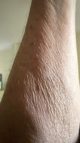 Customer photo review of Besque® Magic Body Oil - Unscented