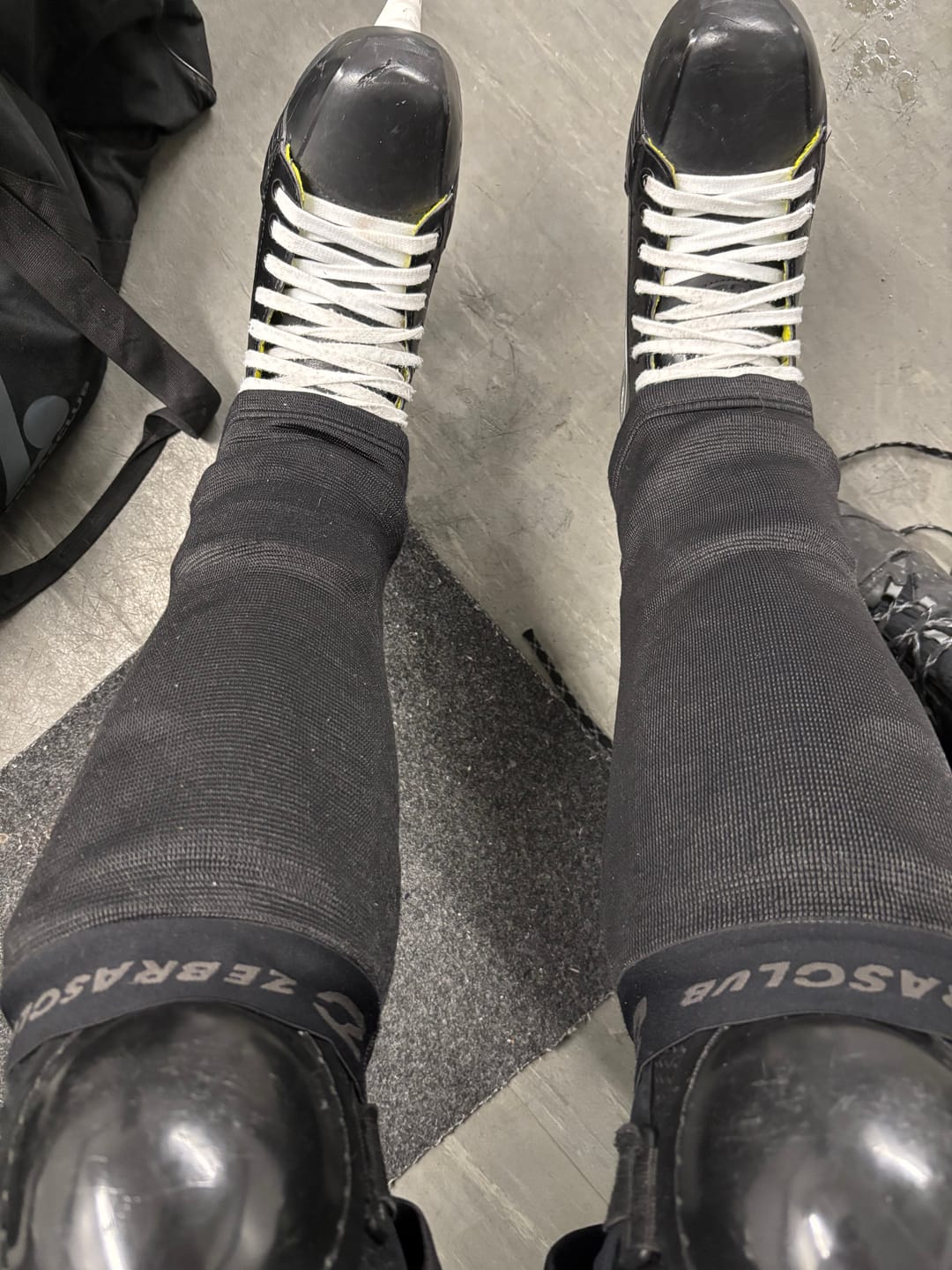 Customer photo review of COMPRESSION SHIN SLEEVE