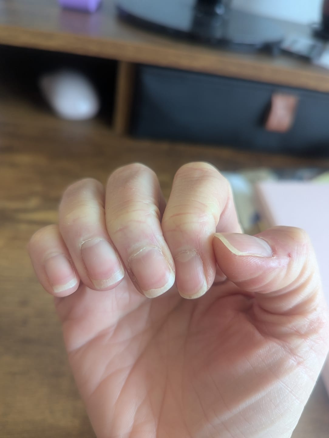Customer photo review of Hair Skin and Nails Protocol