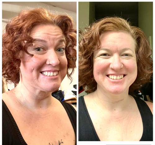 Reviewer's before-and-after image showing smoother skin on her face and neck after using the Grass Fed Tallow & Honey Balm.