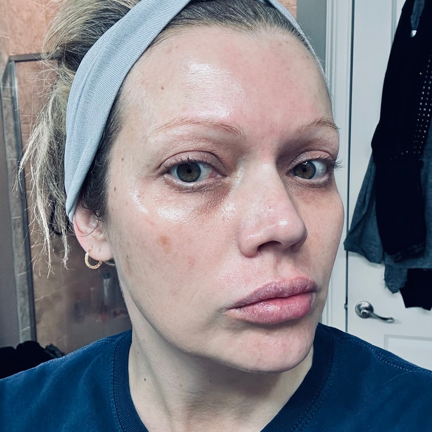 Customer photo review of PDRN collagen overnight mask Firming jelly