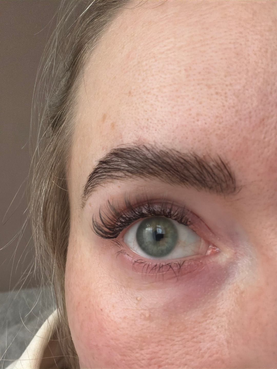 Customer photo review of THE CANCER (Krebs 5-11 mm)