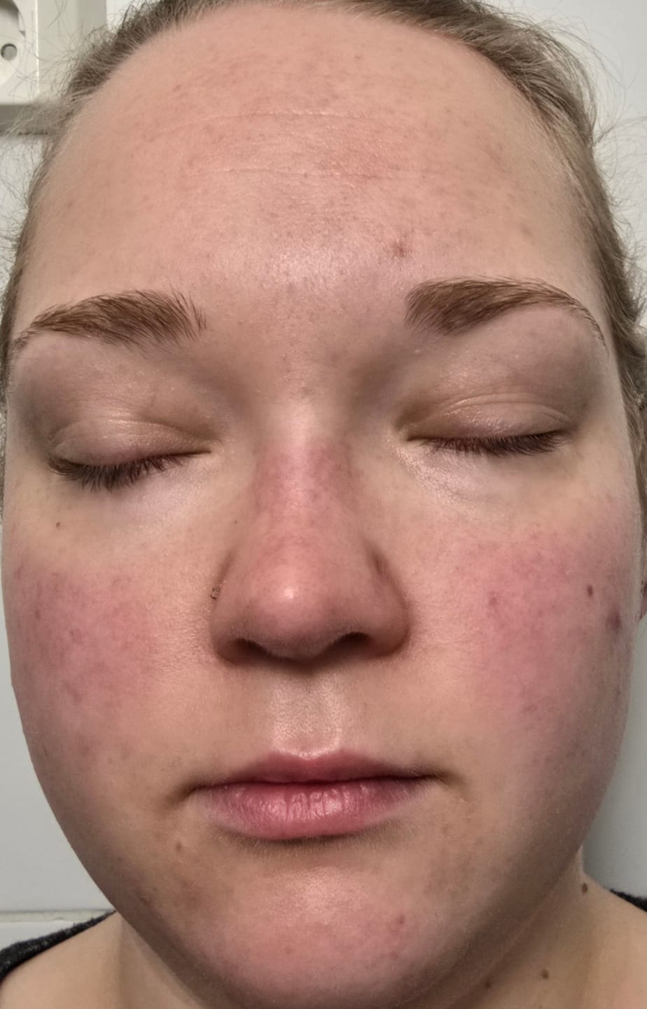 Customer photo review of Sopo Miracle Balm