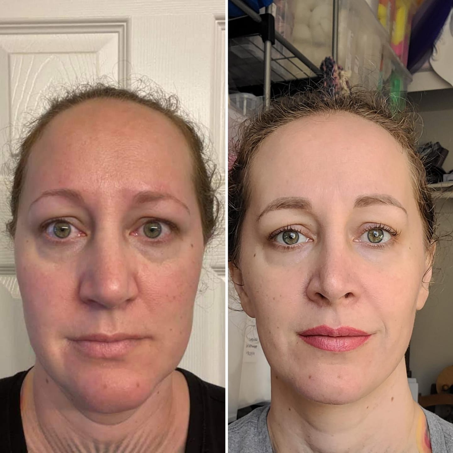 Customer photo review of Buy 1 Get 2 Free - Organix™ - NMN (Nicotinamide Mononucleotide) Pure Powder