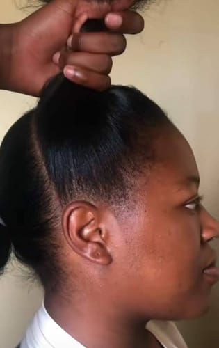 Customer photo review of Minoxidil High Strength (5%) SOLUTION, 3x60ml pack