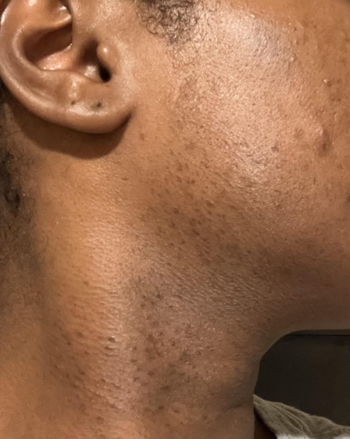 Customer photo review of Liquid African Black Soap Face Wash