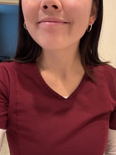 Customer photo review of 22mm Everyday Hoops