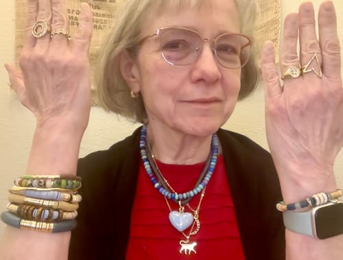 Customer photo review of Storm Zo Bracelet