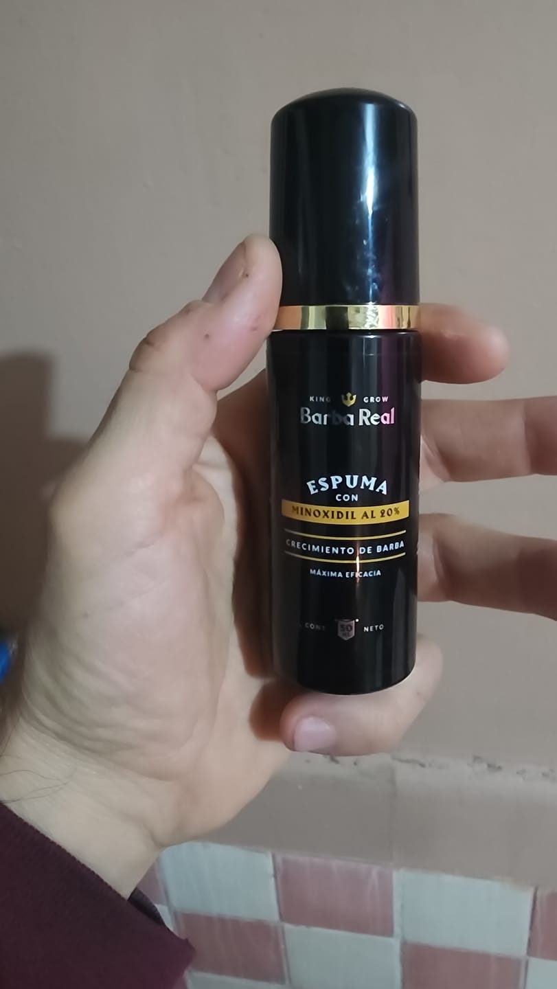 Customer photo review of Minoxidil al 20% | Espuma para Crecimiento de Barba. Formula Mejorada.