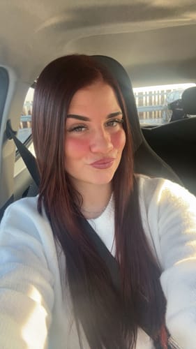 Customer photo review of COSTIQ® EXTREME LIP PLUMPER