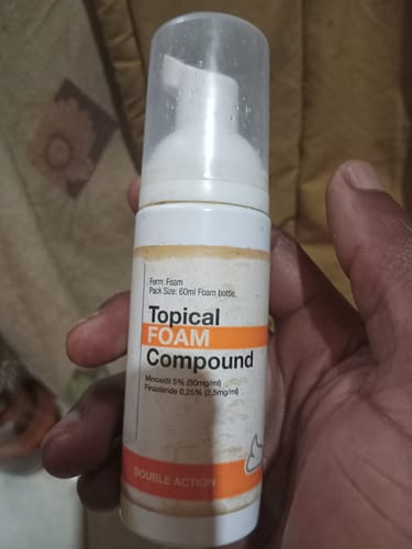 Customer photo review of Minoxidil DOUBLE ACTION FOAM, MEN ONLY 3x60ml Pack