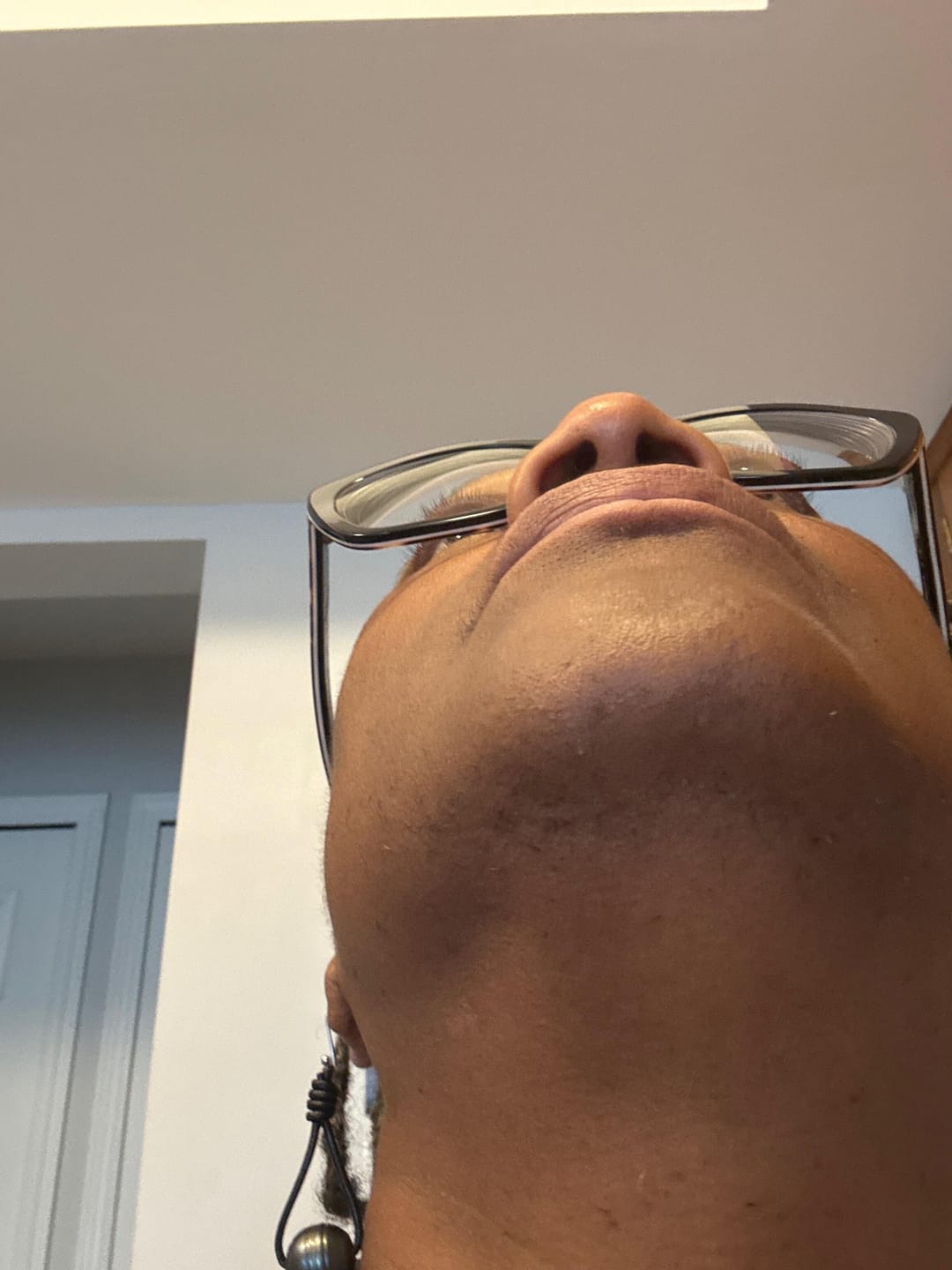 Customer photo review of Hair Reducing Fade Oil - Slows Growth, Thins, and Reduces Hair Naturally