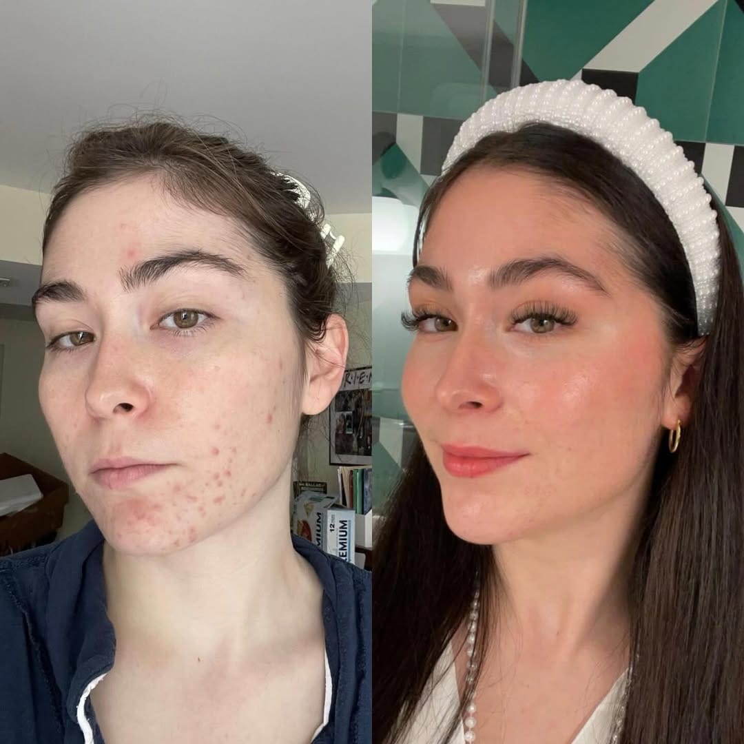 Customer photo review of Buy 1 Get 2 Free - Organix™ - NMN (Nicotinamide Mononucleotide) Pure Powder