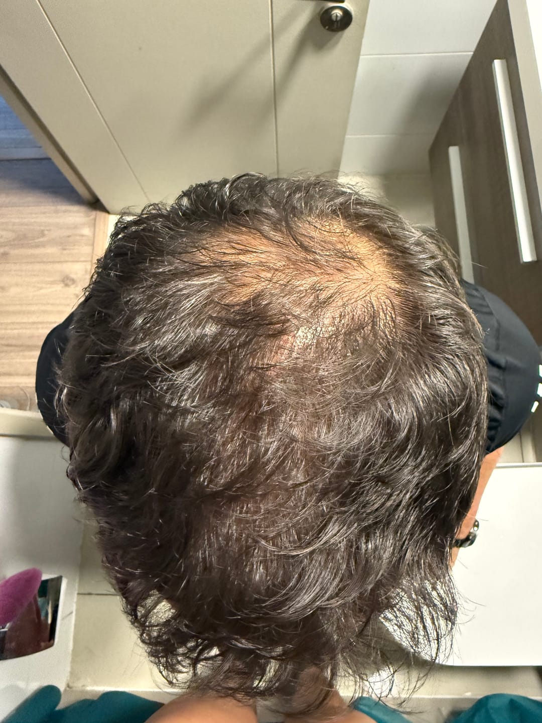 Customer photo review of 90 días de Rutina TRÍO ANTICAÍDA completa con Tónico para Barbas de regalo 🎁🛍️