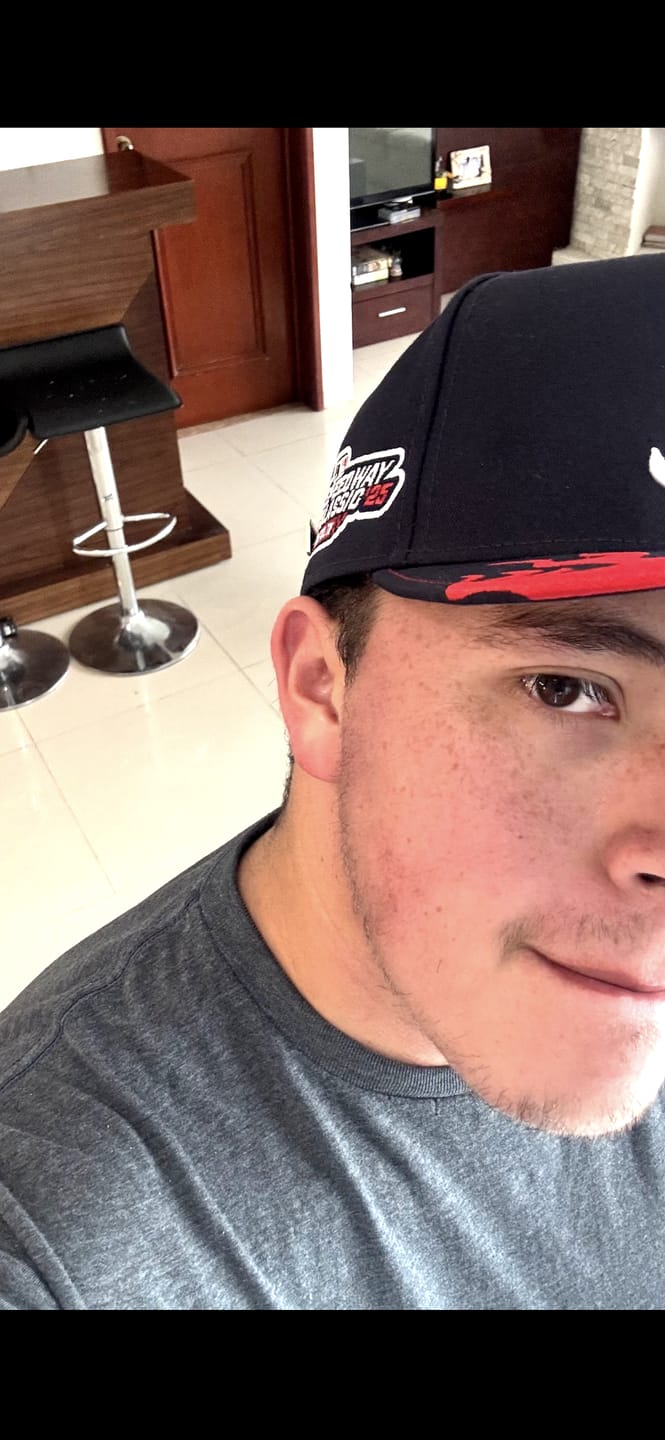Customer photo review of Minoxidil al 20% -Espuma