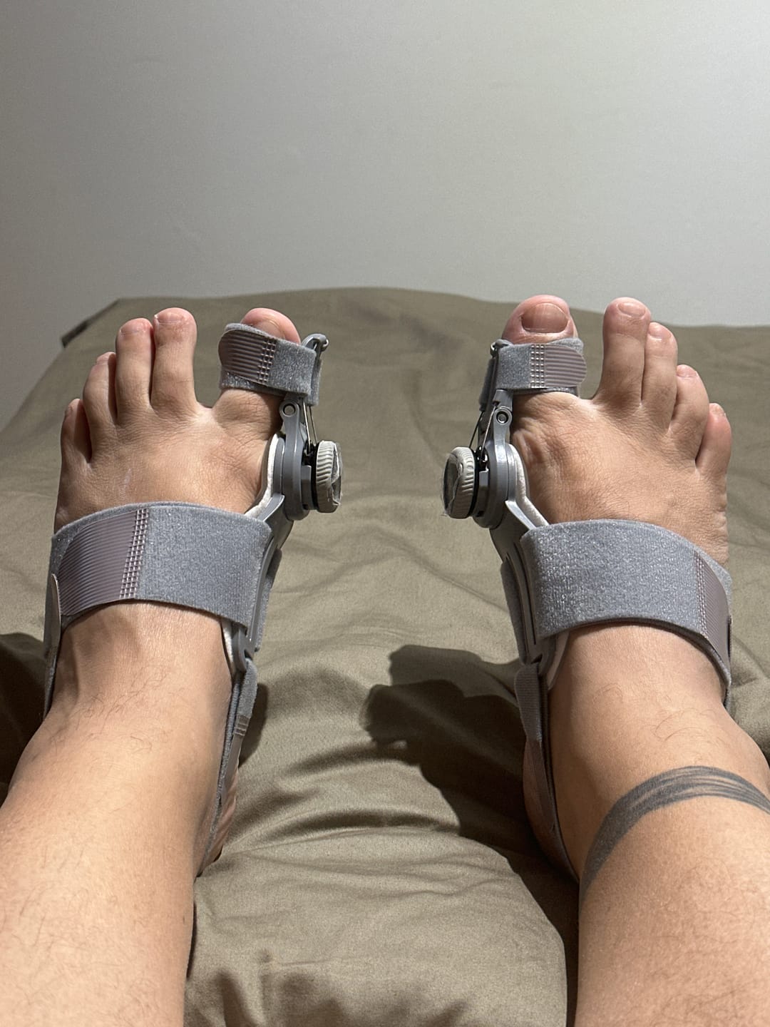 Customer photo review of Foot Medikal
